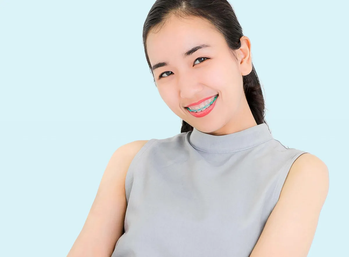 Smiling young woman wearing orthodontic braces during dental treatment at Kong Dental Surgery in Singapore.