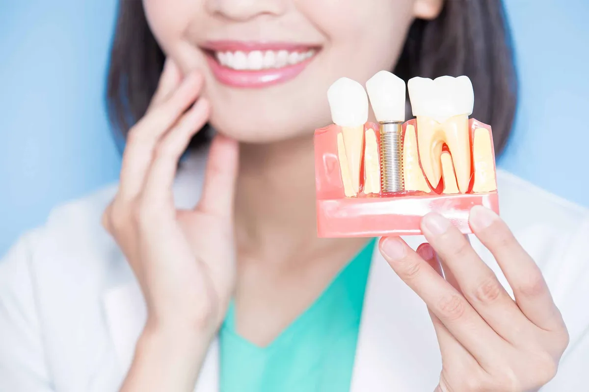 Dental Implants: What You Need to Know
