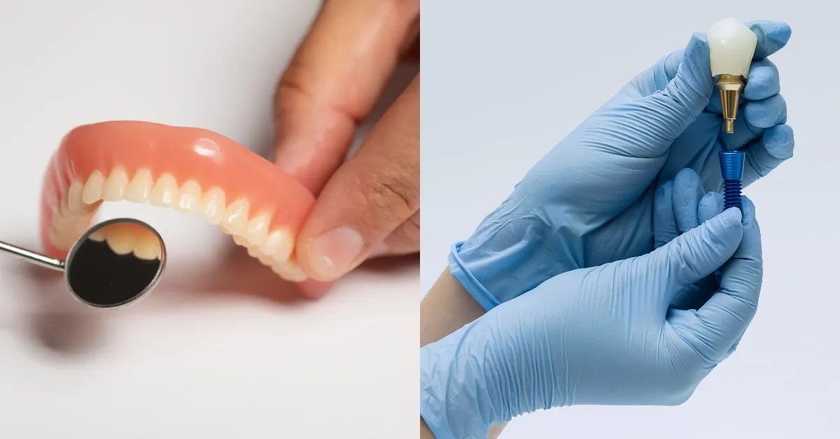 Dentures vs Dental Implants: Understanding the Differences