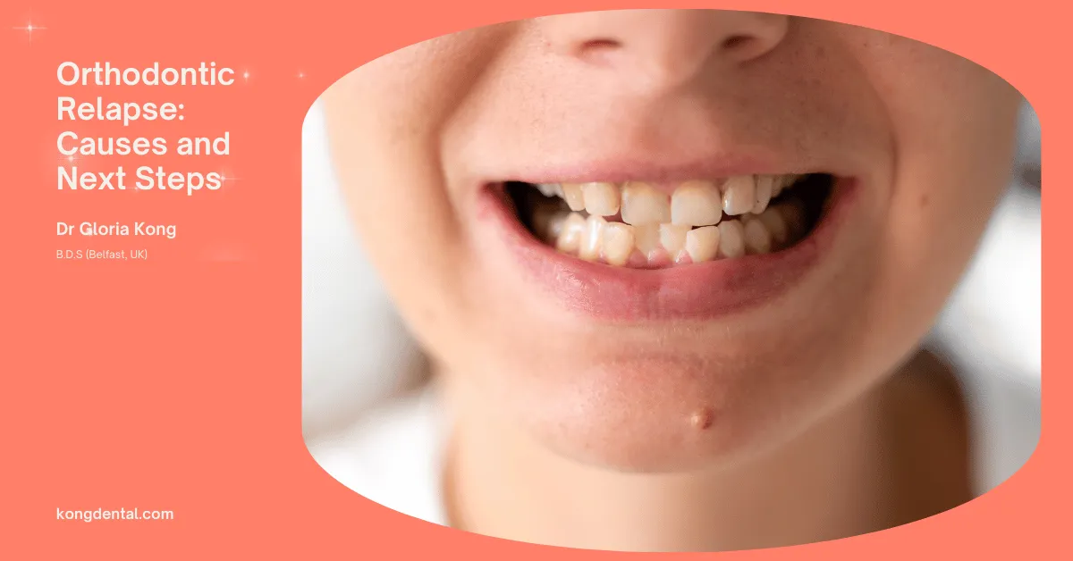 Orthodontic Relapse: Causes and Next Steps
