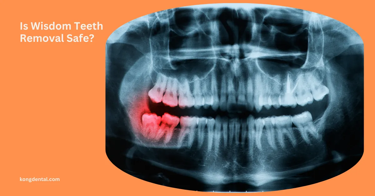 Is Wisdom Teeth Removal Safe? Risks & Considerations