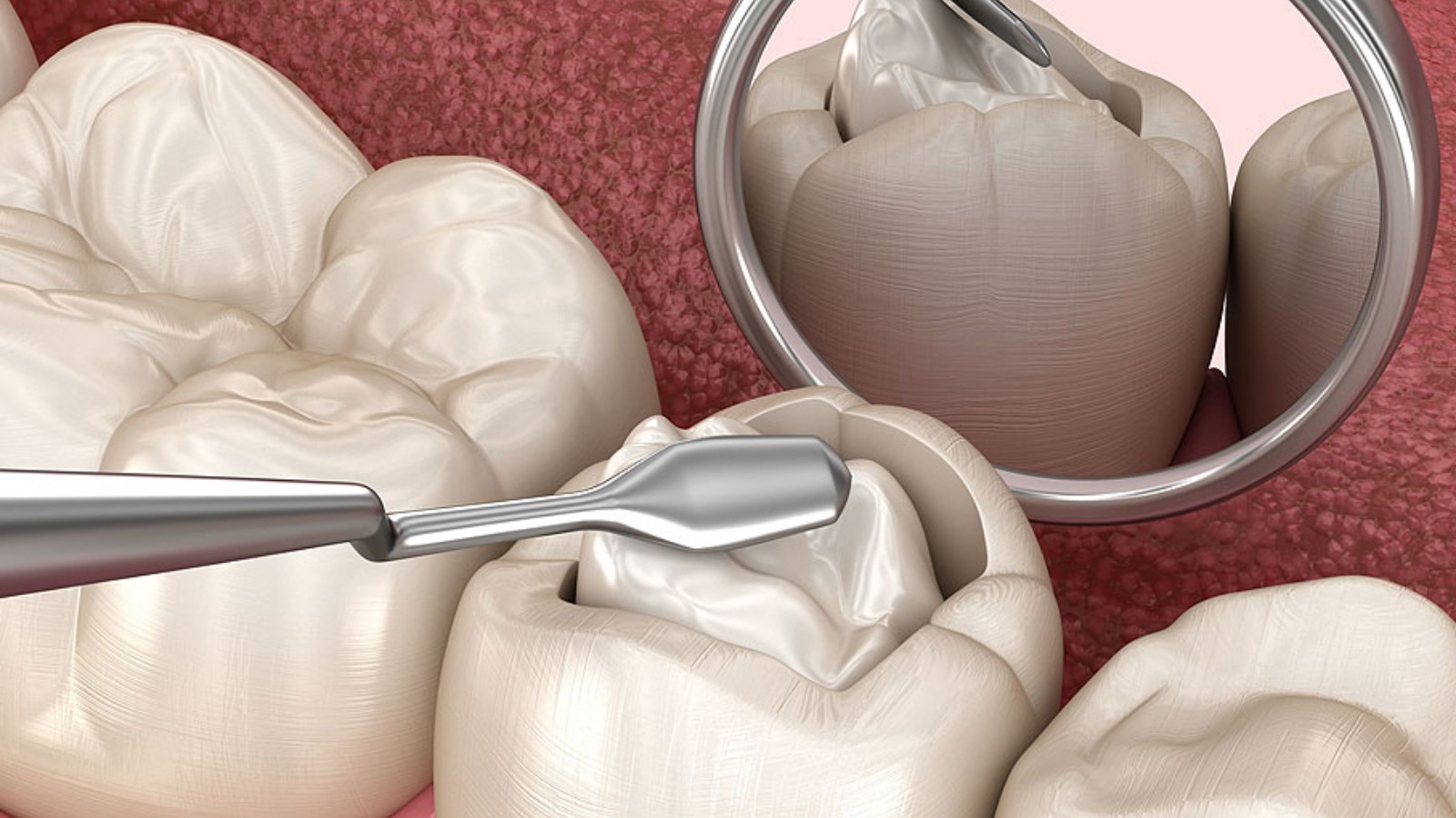 Emergency dental treatment at O'Connor Dental Care North York