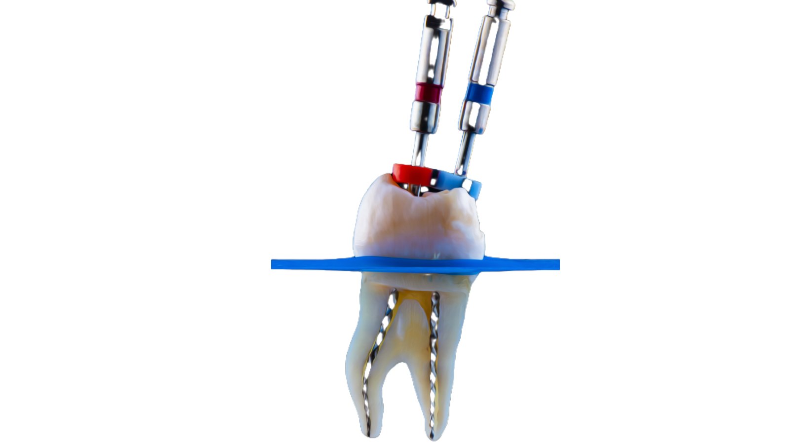 root canal procedure using dental instruments to remove infection