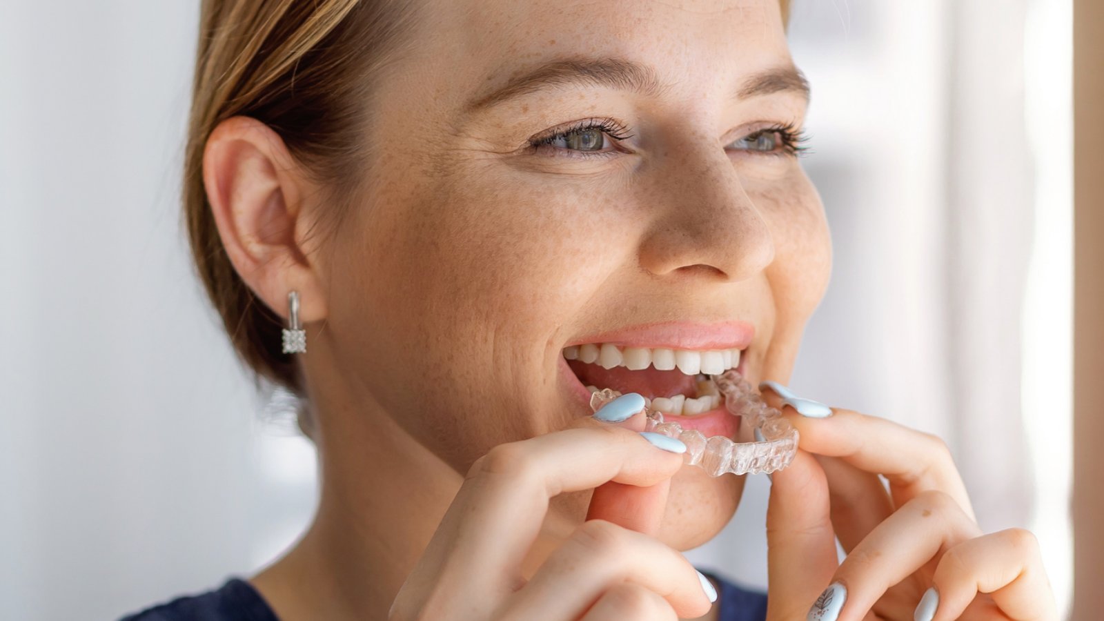 Emergency dental treatment at O'Connor Dental Care North York