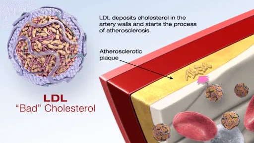 Bad Cholesterol