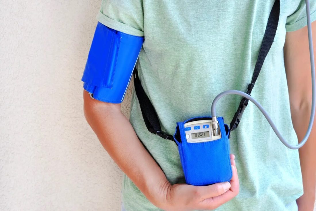 An ambulatory blood pressure monitor attached to a patient's arm