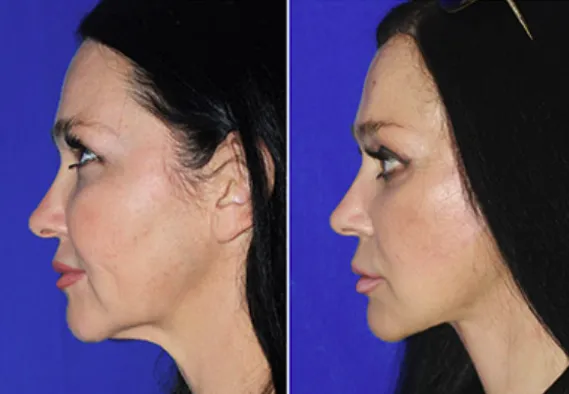 a close up of a yellow and white flower