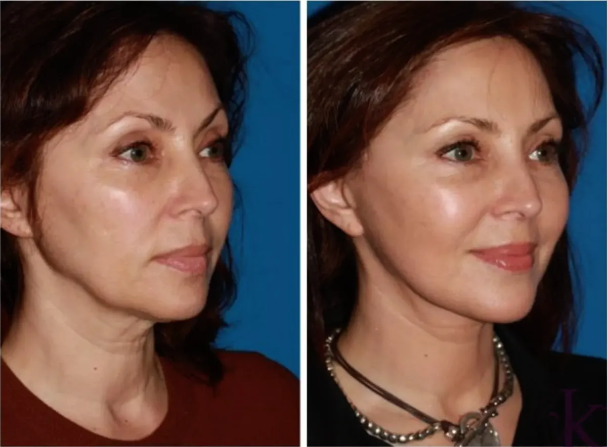 Woman looking at ferris wheel and city skyline