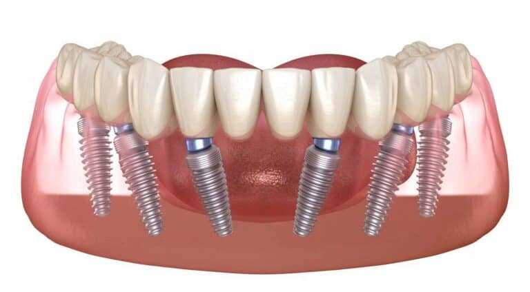 Advanced 3D digital dental scanner in modern clinical practice