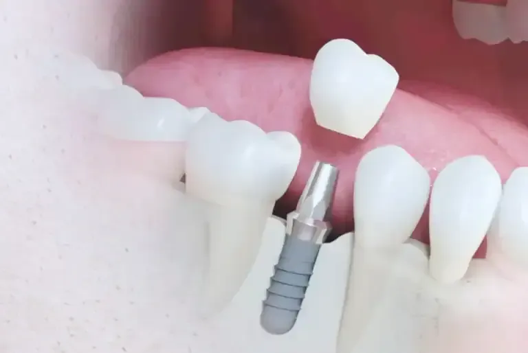 Advanced 3D digital dental scanner in modern clinical practice