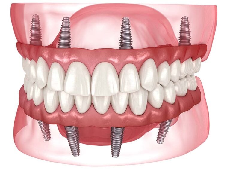 Advanced 3D digital dental scanner in modern clinical practice