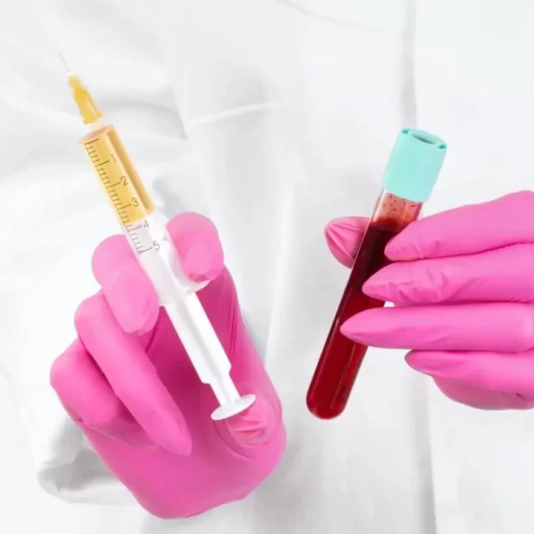 PRP FOR AESTHETICS LIKE BIO FILLERS, MICRNEEDLING AND MORE