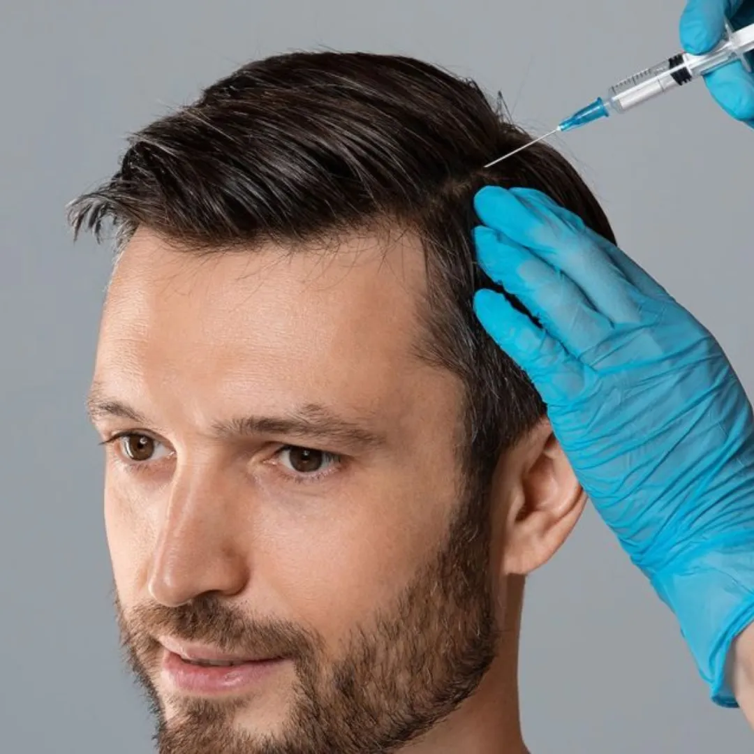 PRP FOR HAIR LOSS AND GROWTH