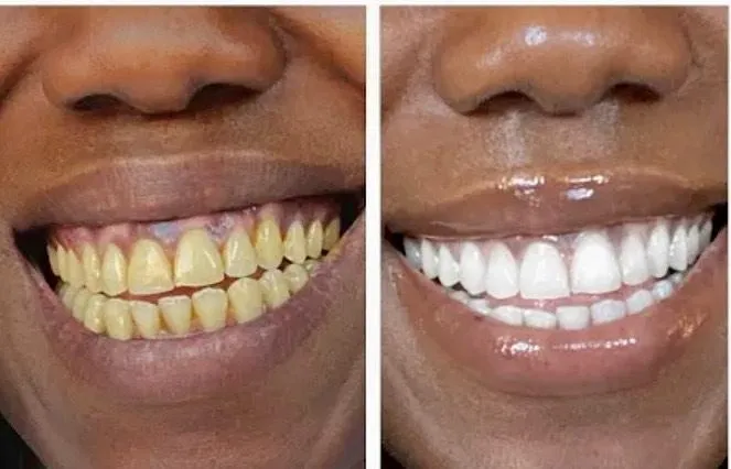 man in black button up shirt