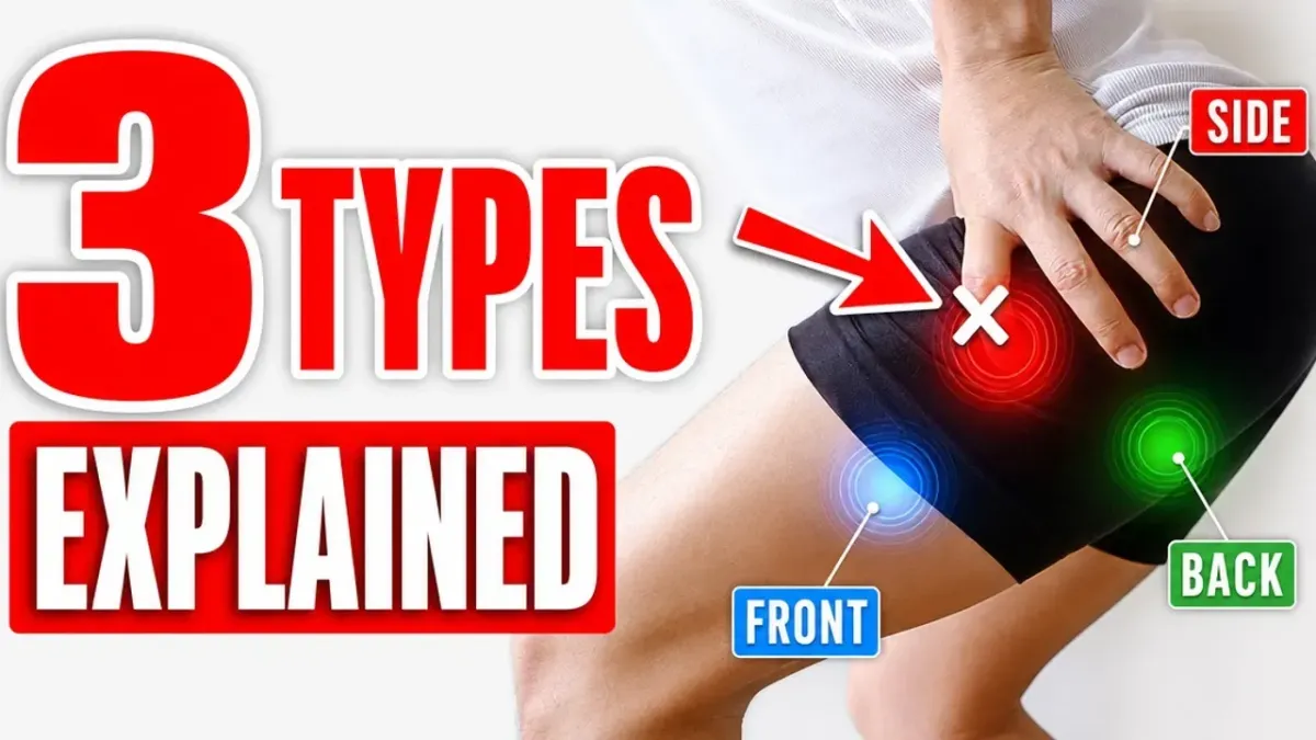 Hip Bursitis in Runners