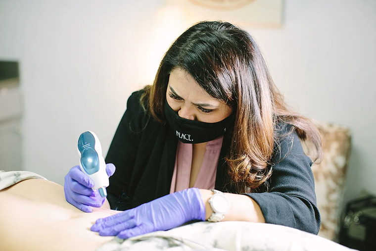 What is Fibroblast Skin Tightening?