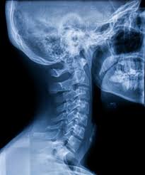 spinal x-ray imaging room