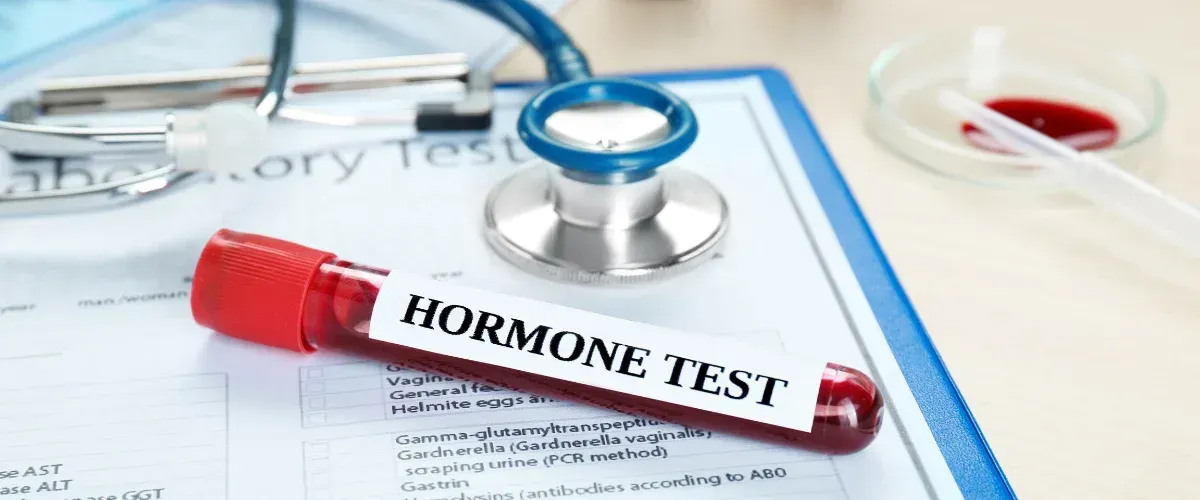 Blood sample tube labeled hormone test on medical laboratory paperwork