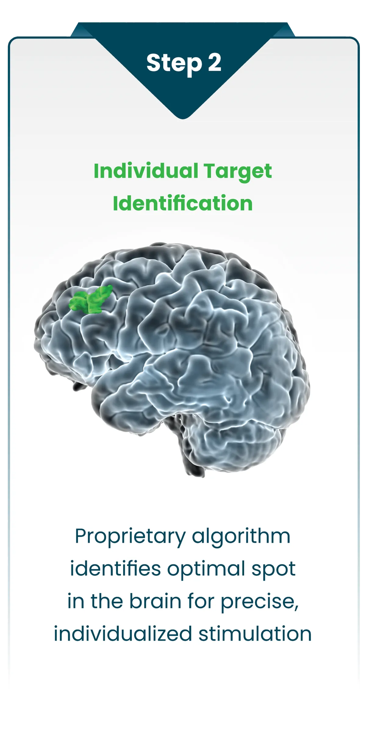 Step 2 of the Saint Neuromodulation showing a highlighted targeted region of the brain