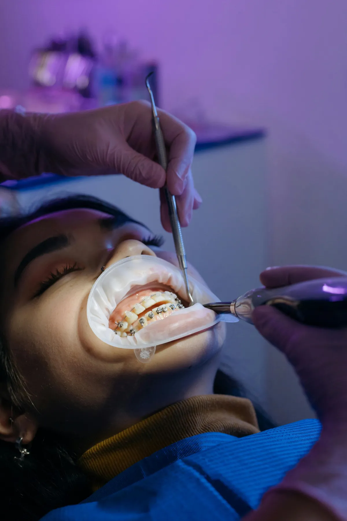 woman at orthodontist getting braces under a light