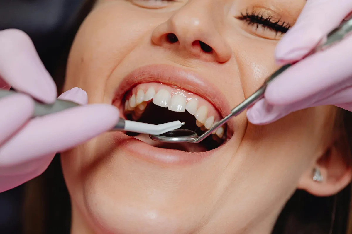 Dental mplant