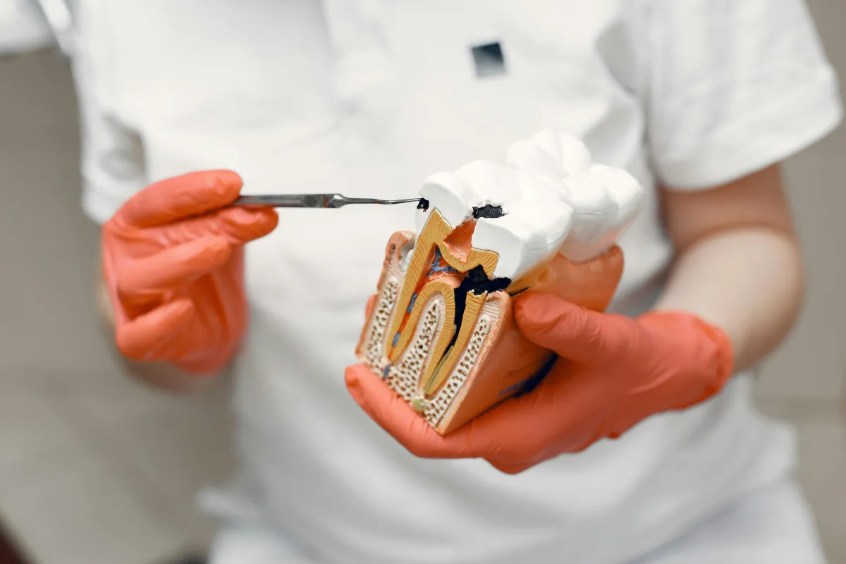 dentist holding a model of a tooth