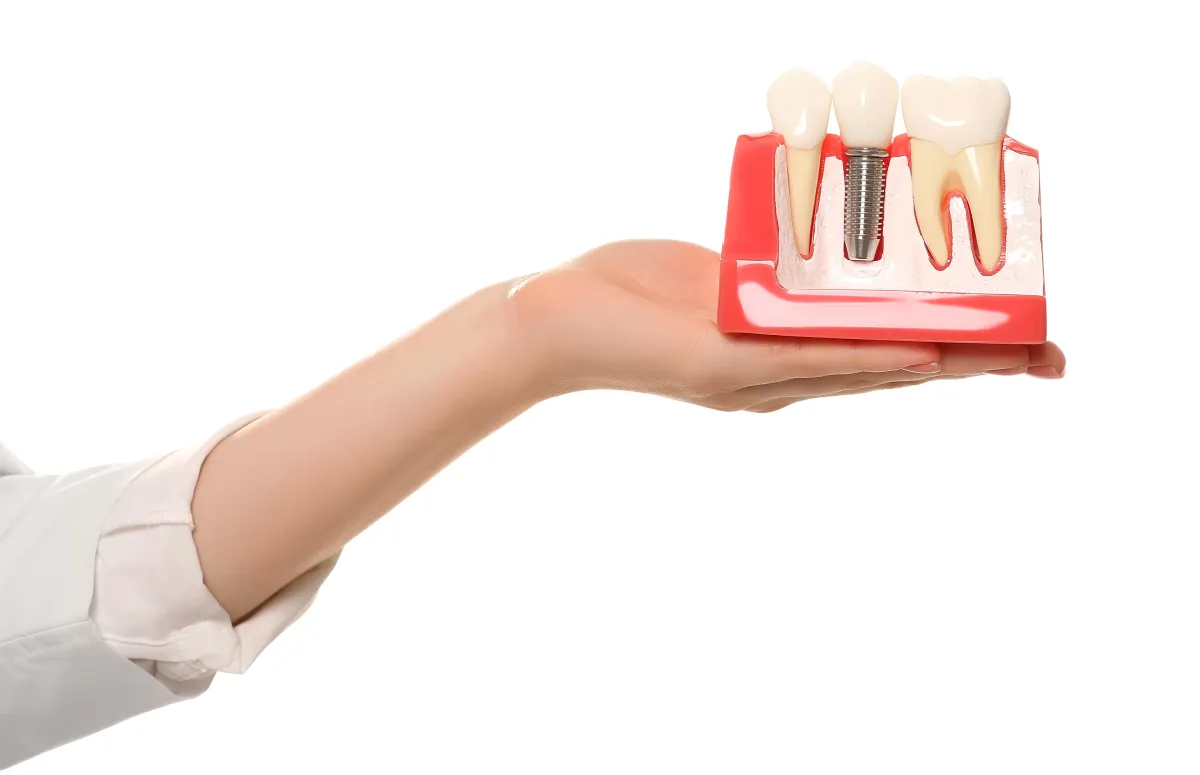 Dental Implant