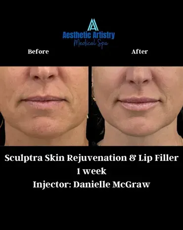 person in white dress shirt wearing green and white hat