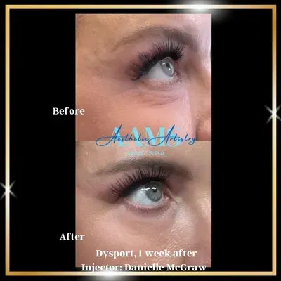 two surgeons performing surgery in a dark room