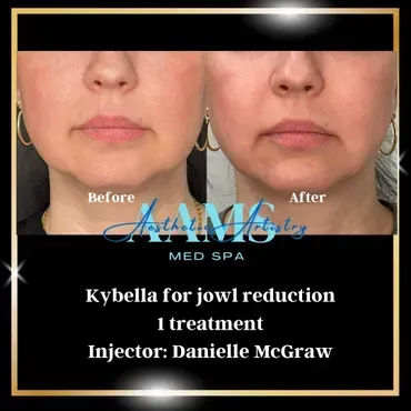 two surgeons performing surgery in a dark room