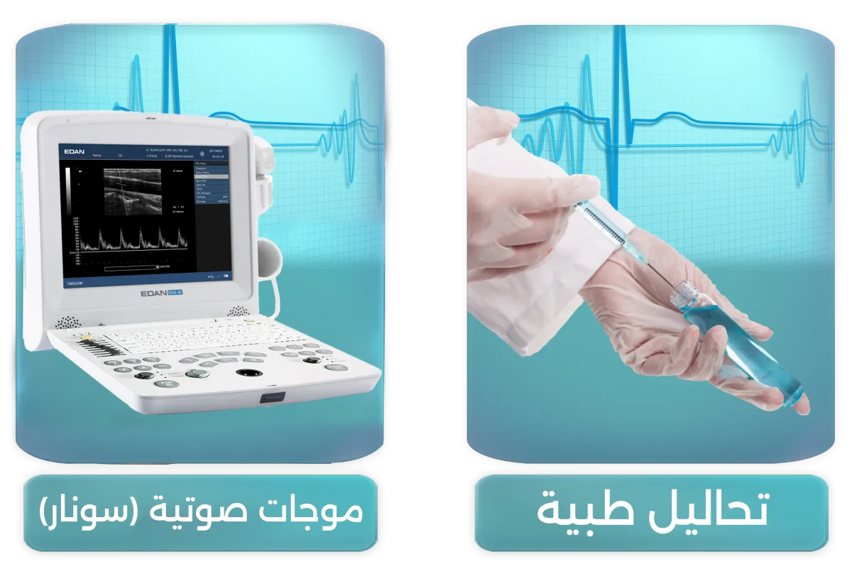 بعض خدمتنا