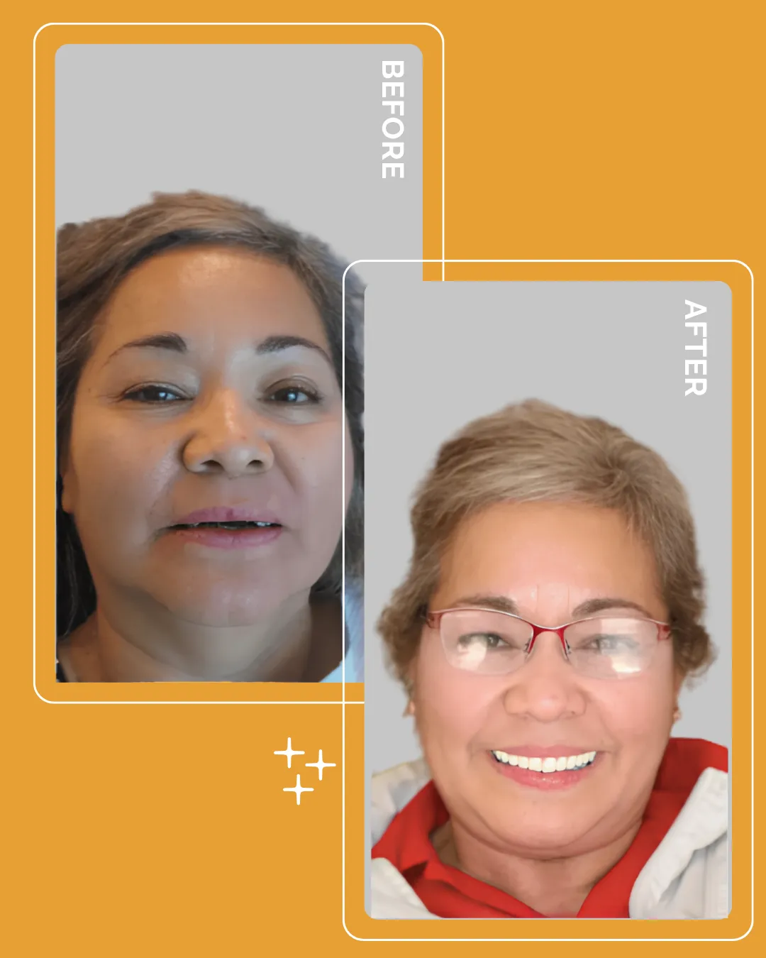 Patient before and after smile transformation