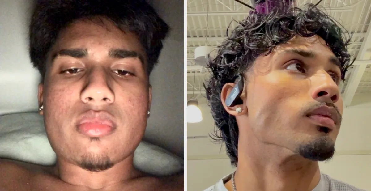 Jawline and Facial Sharpness Blueprint Module