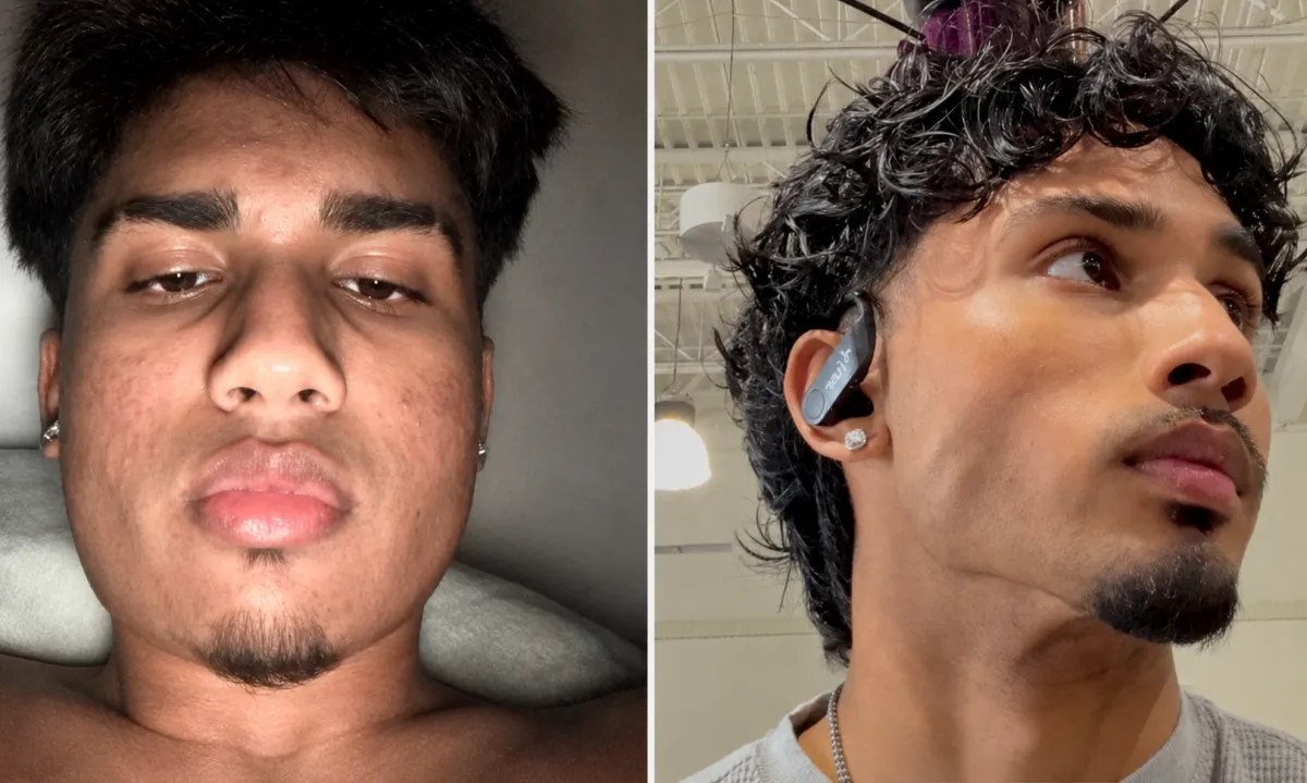 Jawline and Facial Sharpness Blueprint Module