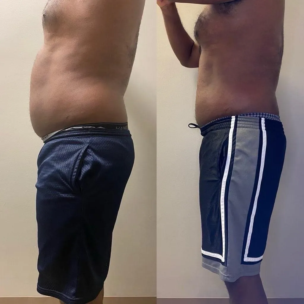 before and after red light therapy man
