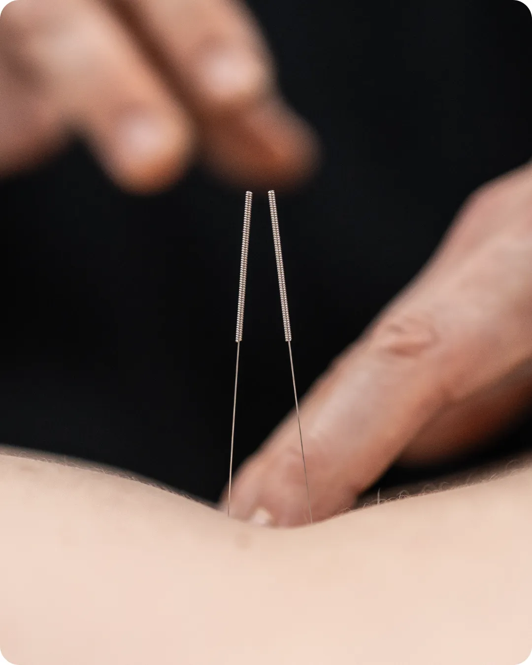 acupuncture-clinic-video-marketing-lb-productions.webp