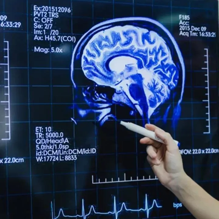 A neurologist in Hagerstown & Cumberland, MD, explaining Laser Interstitial Thermal Therapy (LITT) as a minimally invasive epilepsy treatment.