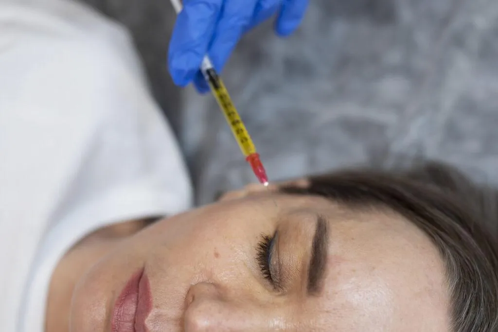 Woman receiving Mesotherapy injection near left eye