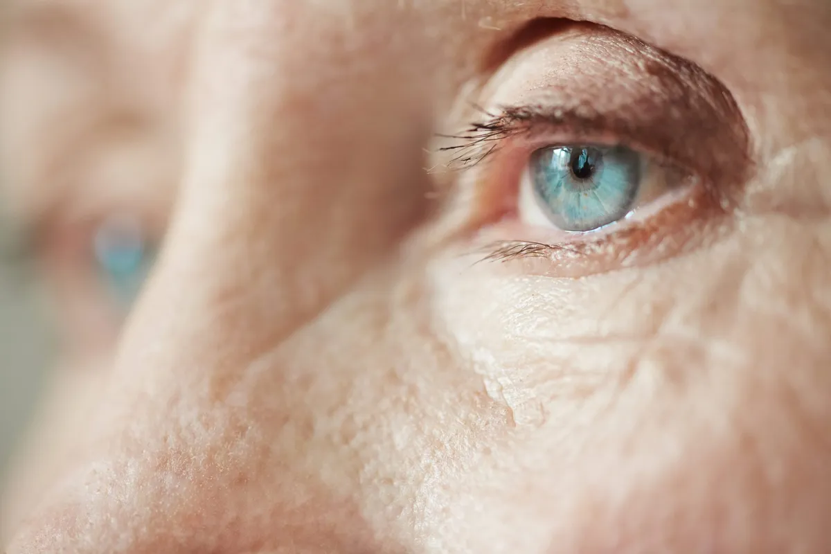 What Is Aging, Really?