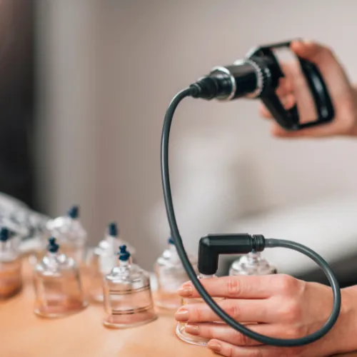 cupping therapy