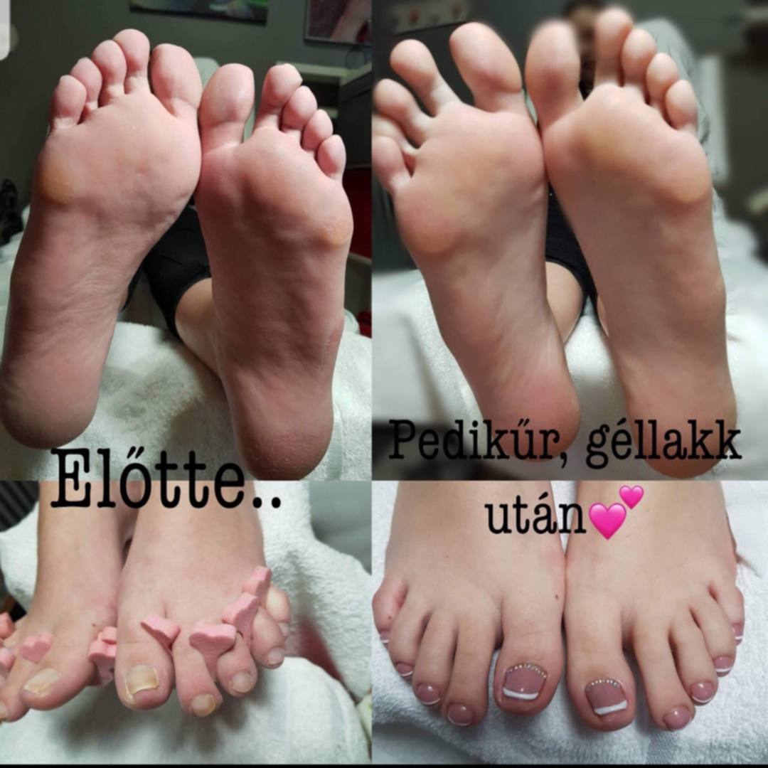 pedikűr békéscsaba