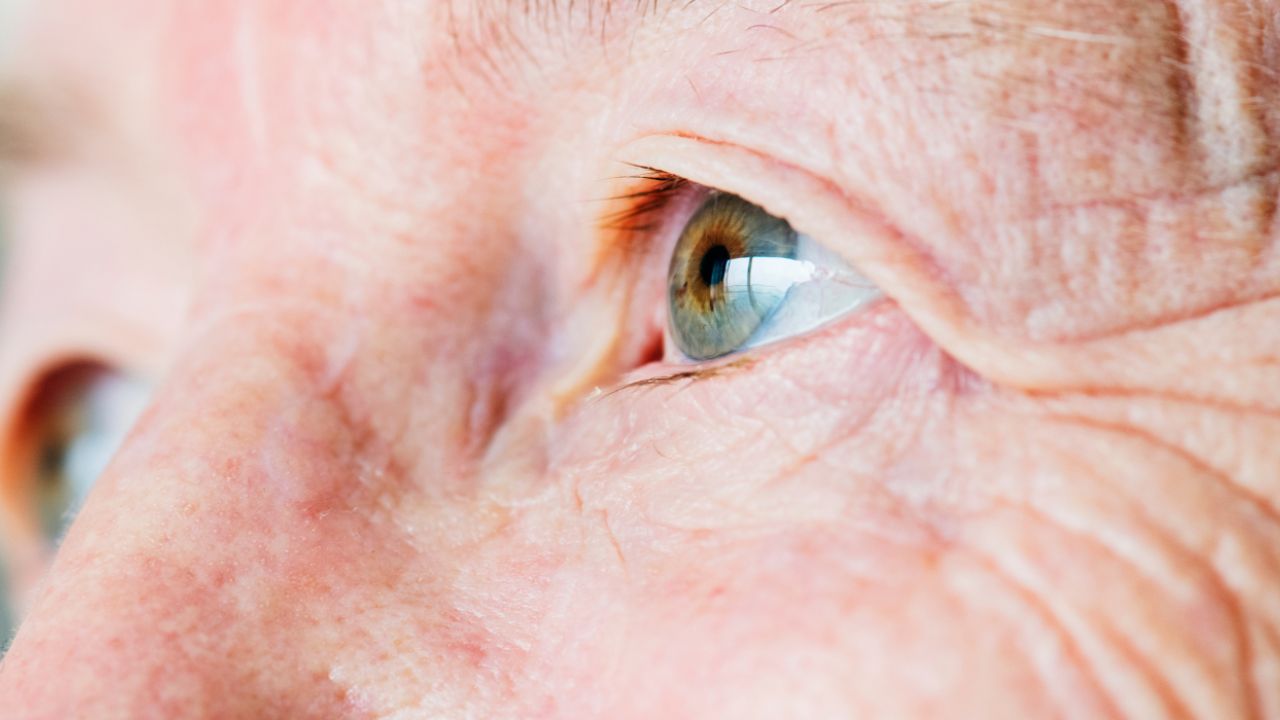 Degeneración Macular: Principal Causa de Ceguera en Adultos Mayores