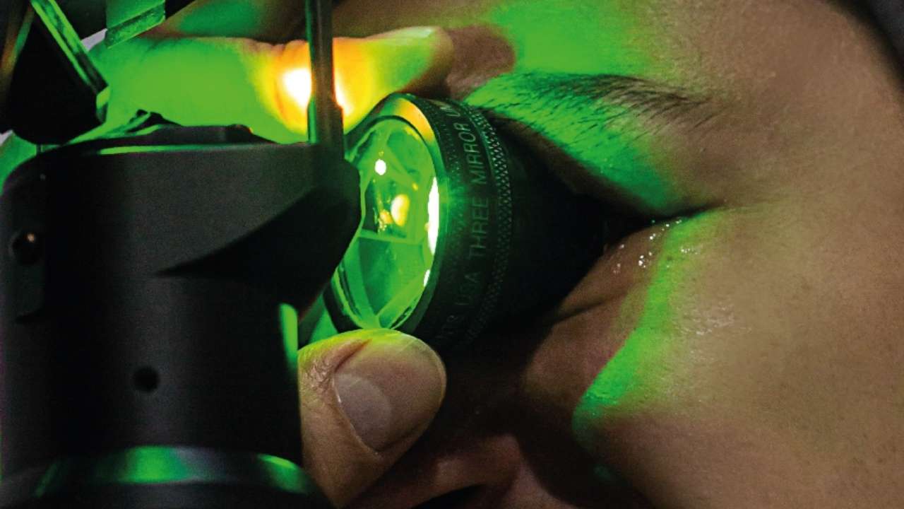 Fotocoagulación Láser de Retina: Tratamiento para Enfermedades Retinianas