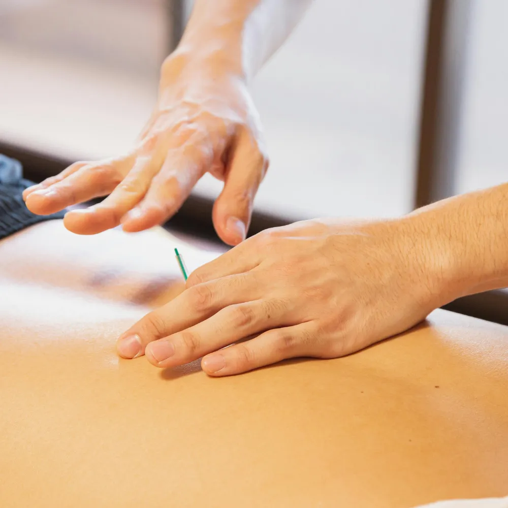 Dry Needling