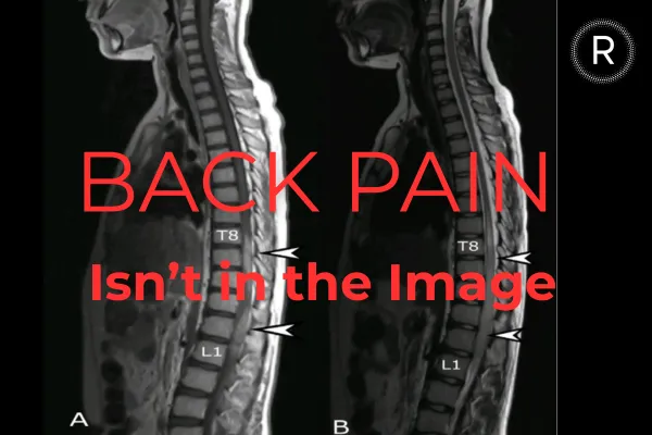 Back Pain Isn’t in the Image