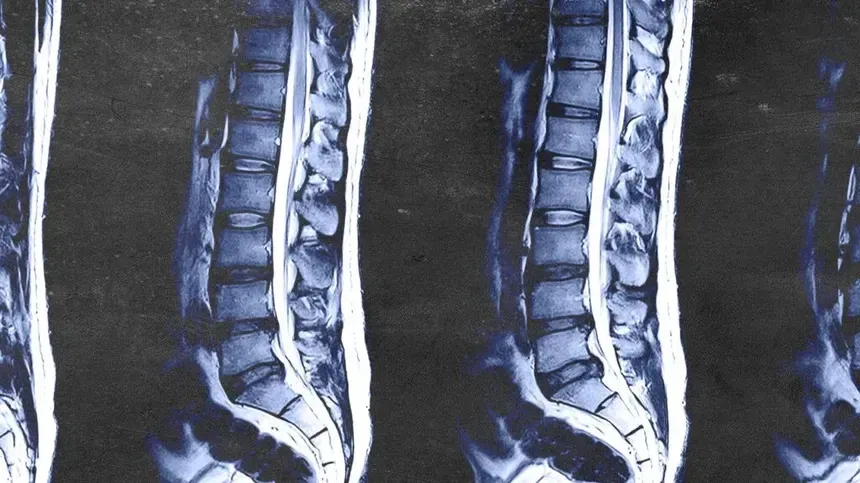 Back Pain Isn’t in the Image