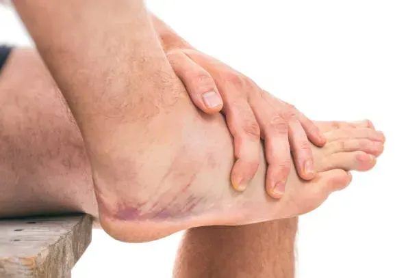 Ankle Sprains: Why Weight Bearing Speeds Healing