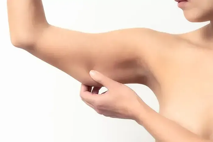 Chin an Neck Liposuction