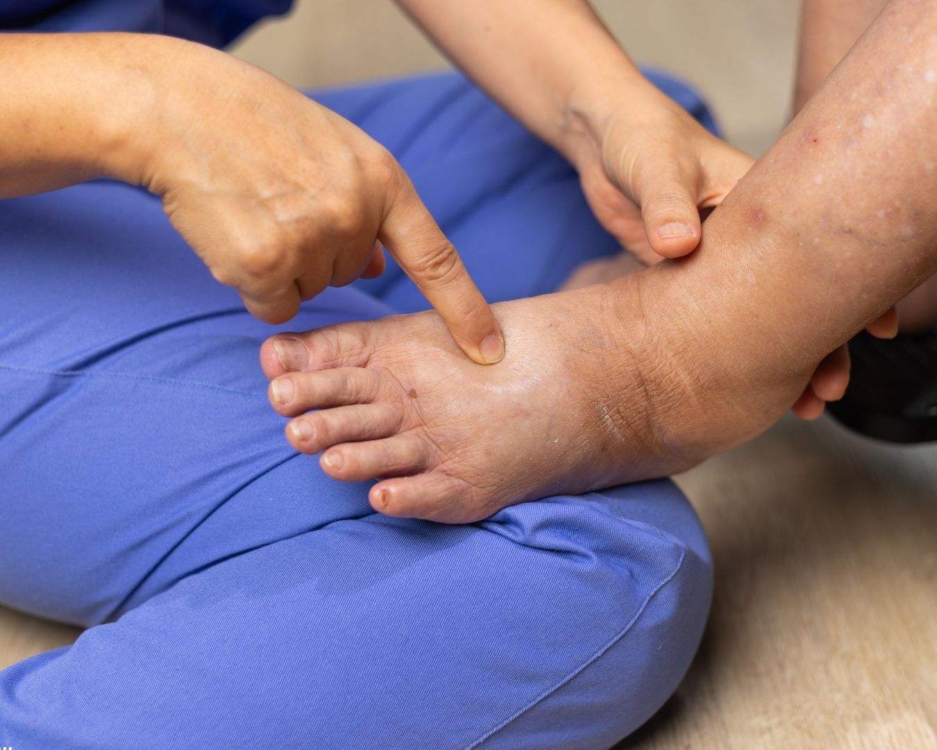 When to Refer for a Lymphedema Pump: A Clinical Guide | 2026