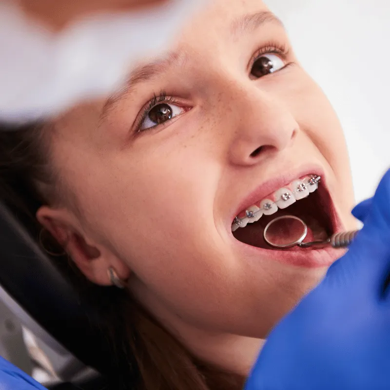 A young boy getting an Orthodontic checkup